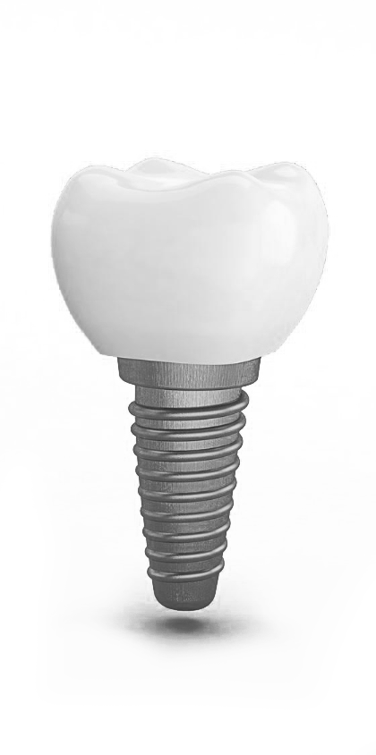 implante-dental